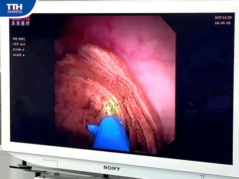 Bệnh cảnh phức tạp của bệnh nhân