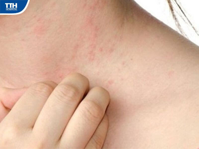 Biện pháp phòng ngừa bệnh gan