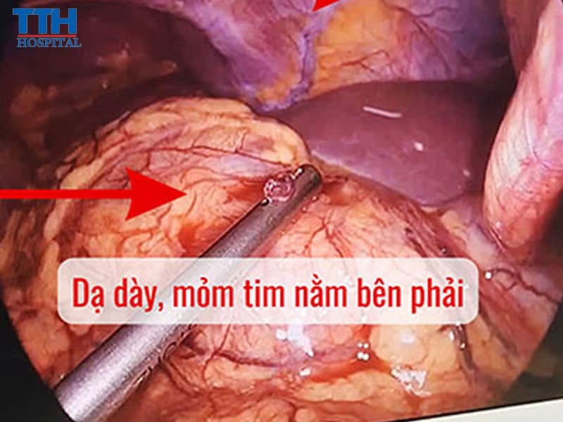 Chẩn đoán chính xác – Quyết định nhanh chóng, phẫu thuật kịp thời