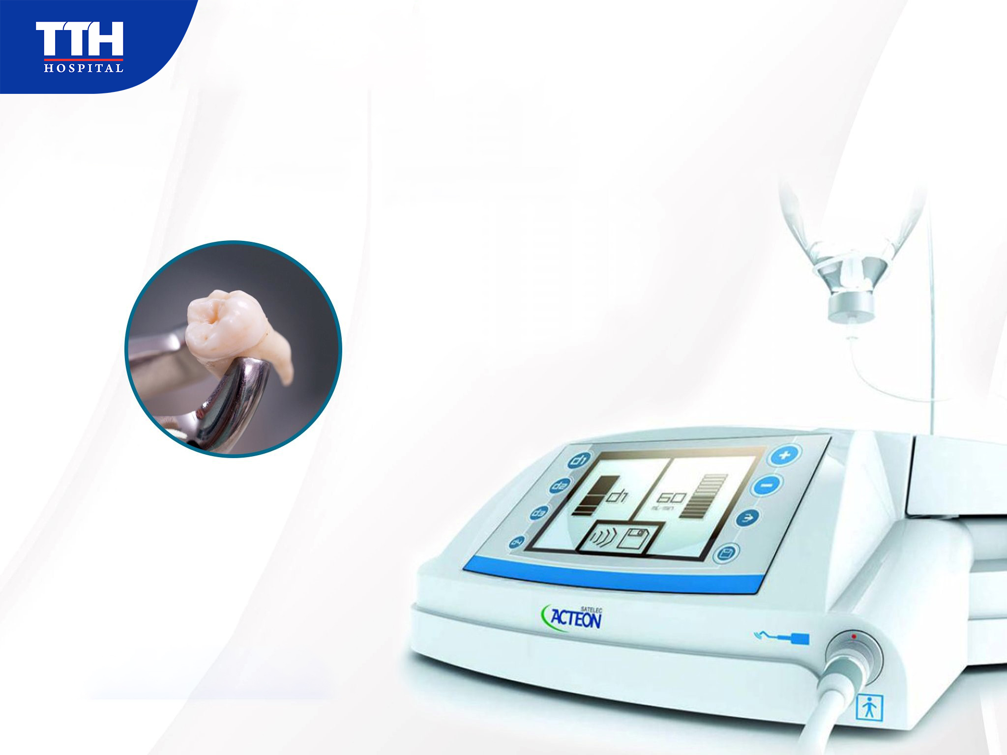 Công nghệ sóng siêu âm Piezotome là gì?