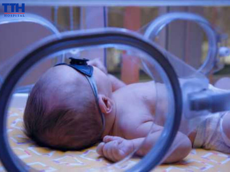 Làm thế nào để chăm sóc trẻ bị vàng da đúng cách