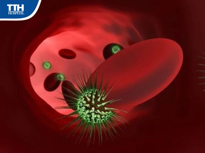 Nguyên nhân dẫn đến nhiễm trùng huyết