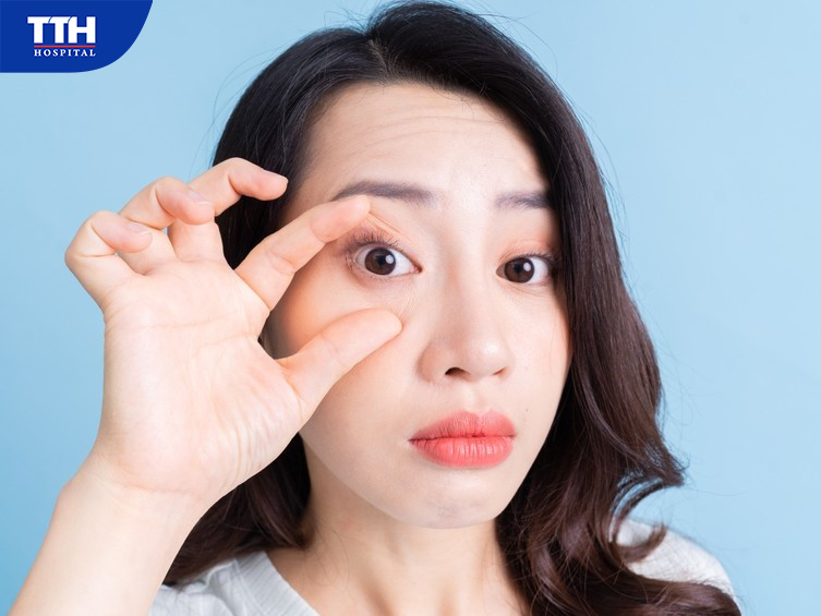 Quặm mi là gì?
