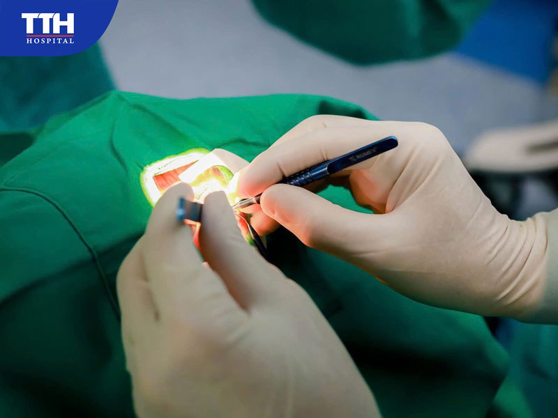 Bệnh viện Đa khoa TTH Quảng Bình - Địa chỉ phẫu thuật Phaco uy tín, an toàn