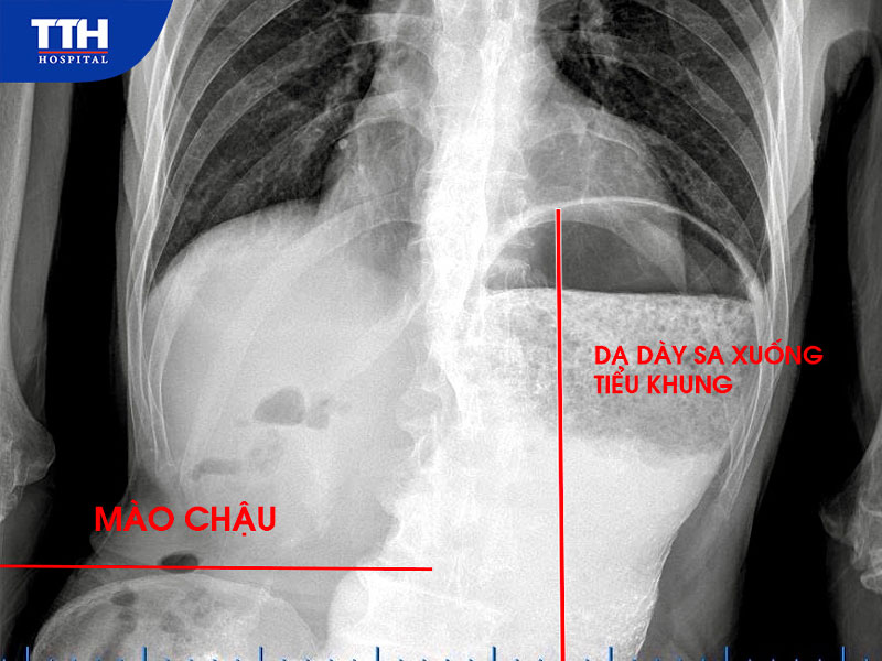 Tình trạng bệnh nhân