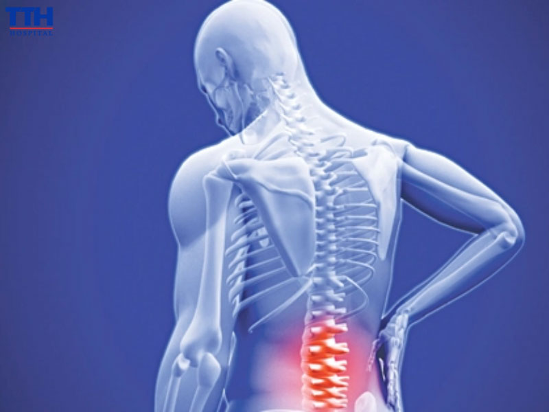 Vì sao không nên chủ quan với thoát vị đĩa đệm?