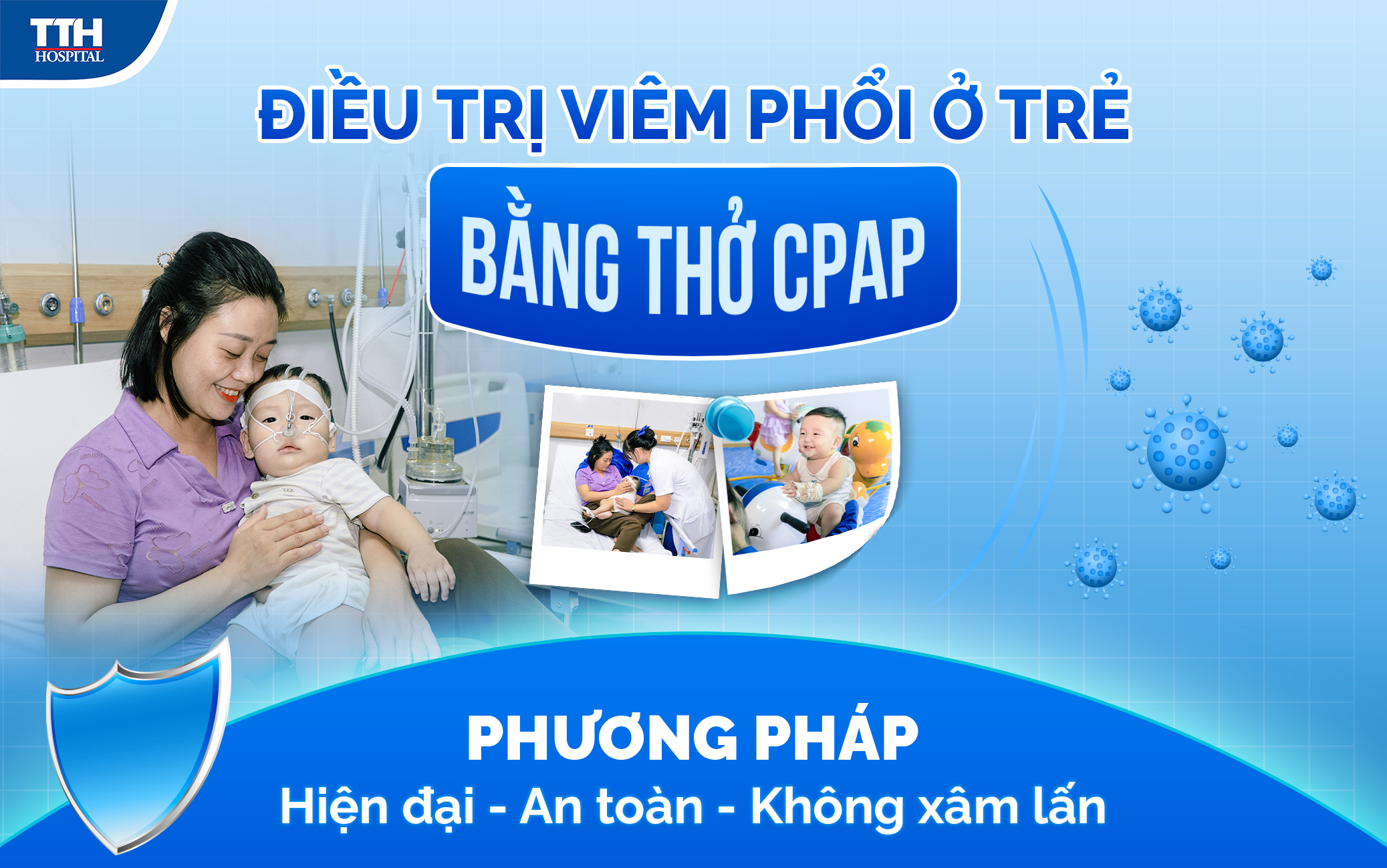 Ưu điểm vượt trộ của phương pháp thở CPAP trong điều trị viêm phổi ở trẻ