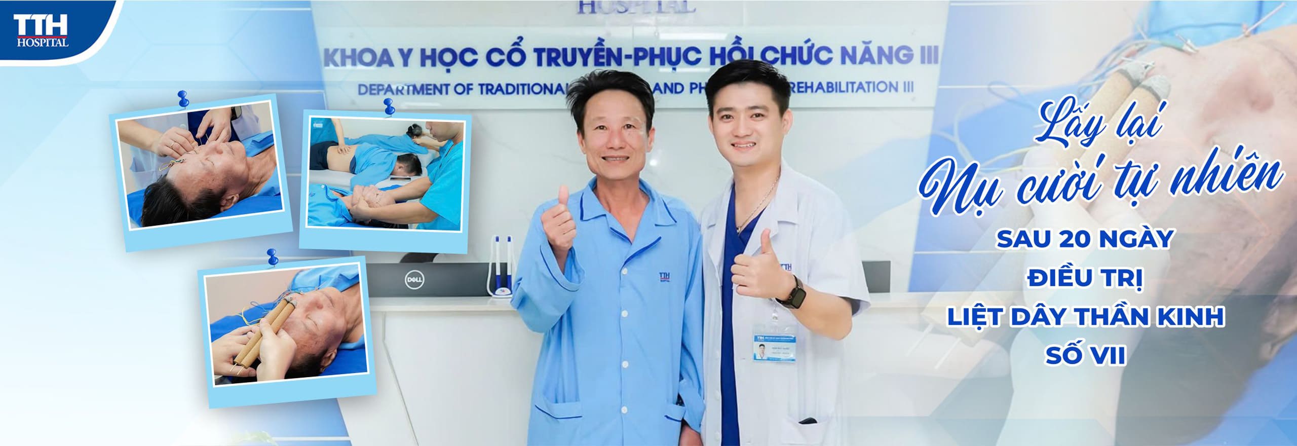 Lấy lại nụ cười tự nhiên sau 20 ngày điều trị liệt dây thần kinh số VII