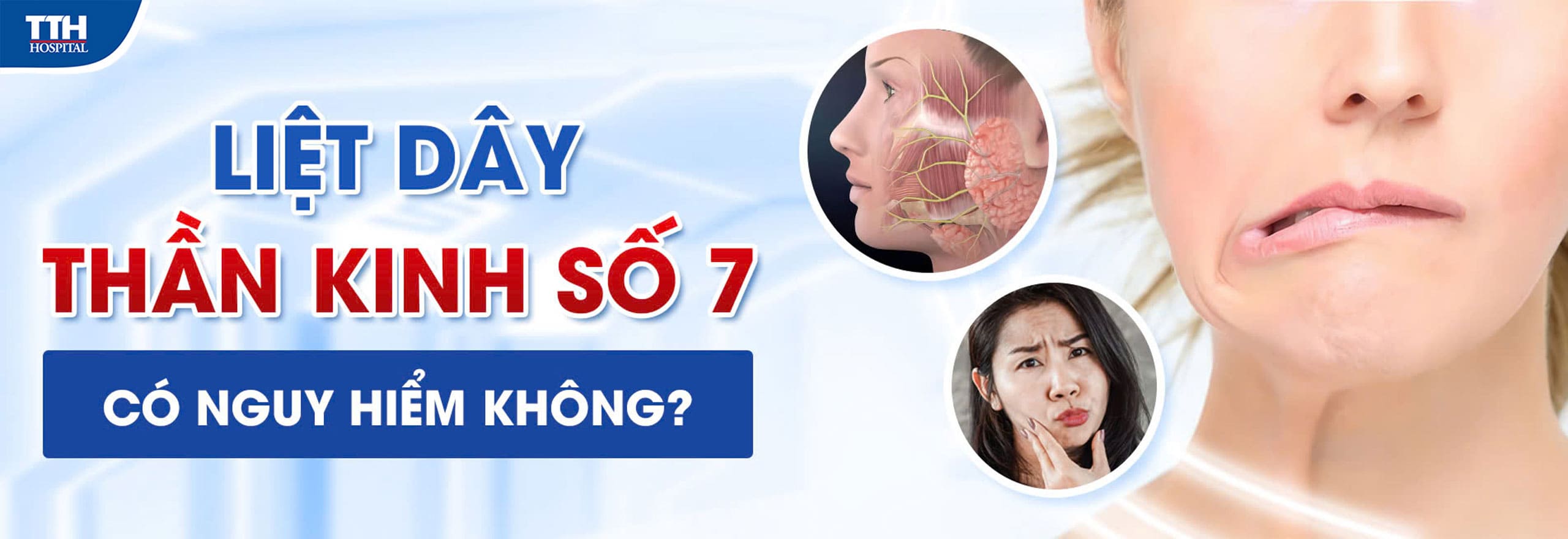 LIỆT DÂY THẦN KINH SỐ 7 CÓ NGUY HIỂM KHÔNG? NGUYÊN NHÂN VÀ CÁCH ĐIỀU TRỊ