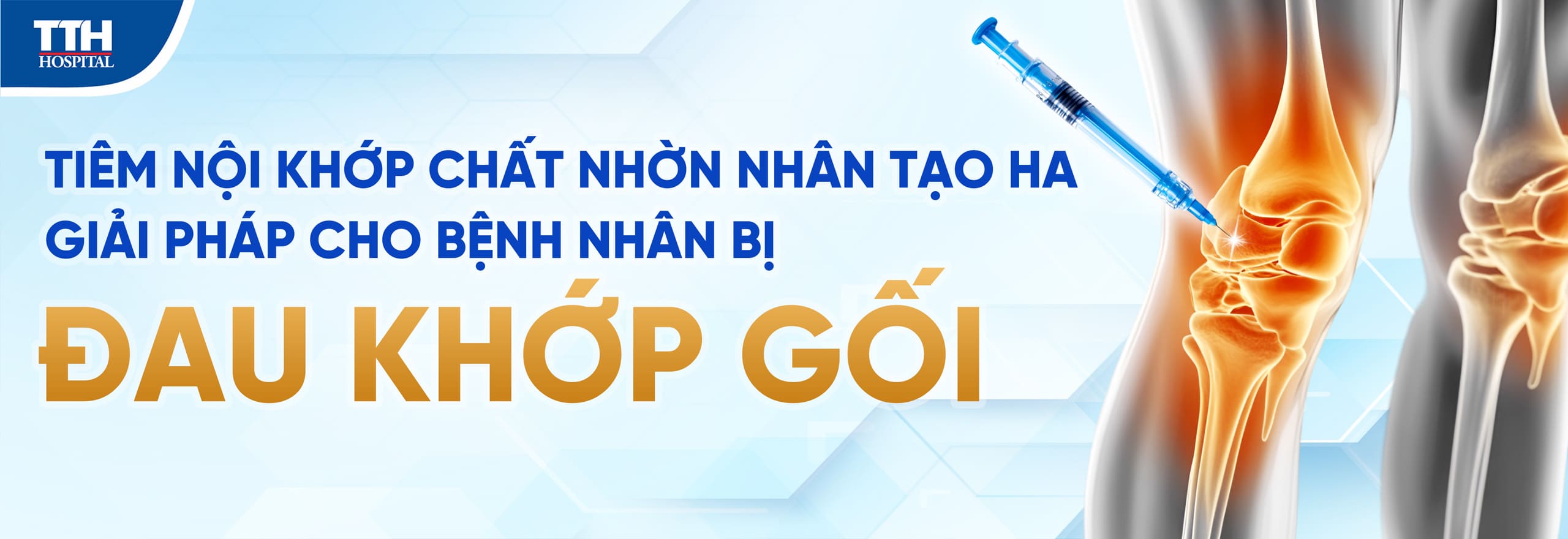 Tiêm nội khớp chất nhờn nhân tạo HA - Giải pháp hiệu quả cho bệnh nhân bị đau khớp gối