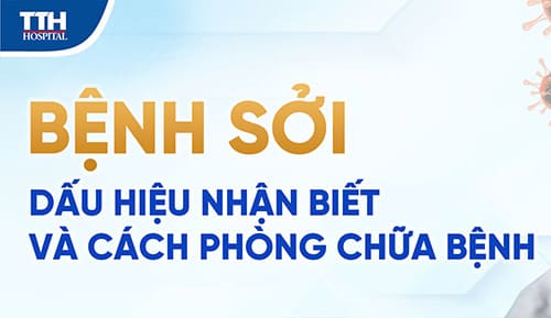 Bệnh sởi: Dấu hiệu nhận biết và cách phòng chữa bệnh