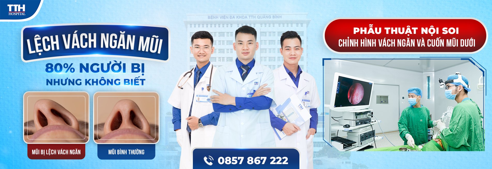 Lệch vách ngăn mũi - 80% người bị nhưng không biết