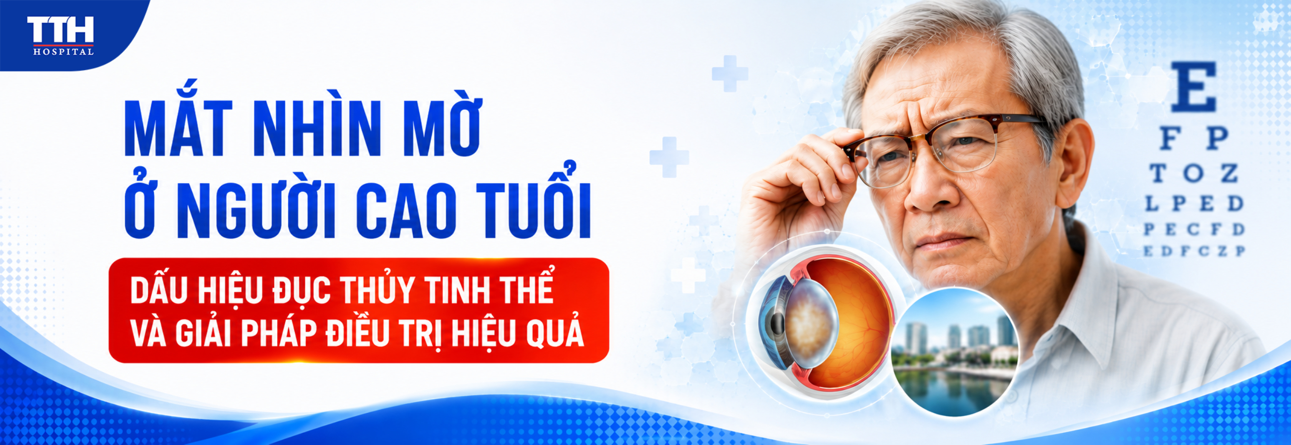 MẮT NHÌN MỜ Ở NGƯỜI CAO TUỔI: DẤU HIỆU ĐỤC THỦY TINH THỂ VÀ GIẢI PHÁP ĐIỀU TRỊ HIỆU QUẢ