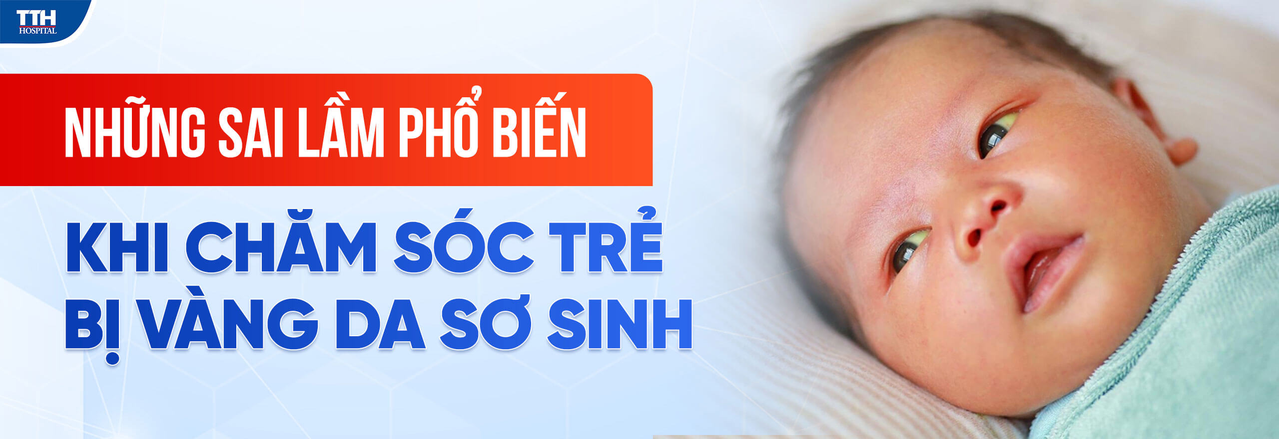 NHỮNG SAI LẦM PHỔ BIẾN KHI CHĂM SÓC TRẺ BỊ VÀNG DA SƠ SINH