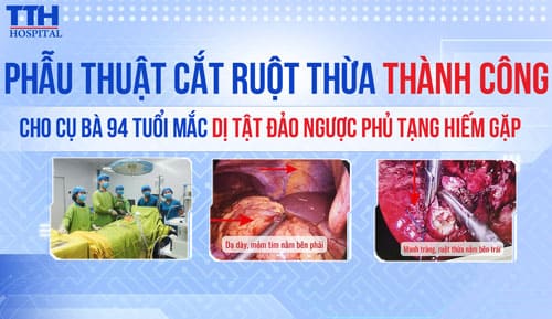 Phẫu Thuật Cắt Ruột Thừa Thành Công Cho Cụ Bà 94 Tuổi Mắc Dị Tật Đảo Ngược Phủ Tạng Hiếm Gặp