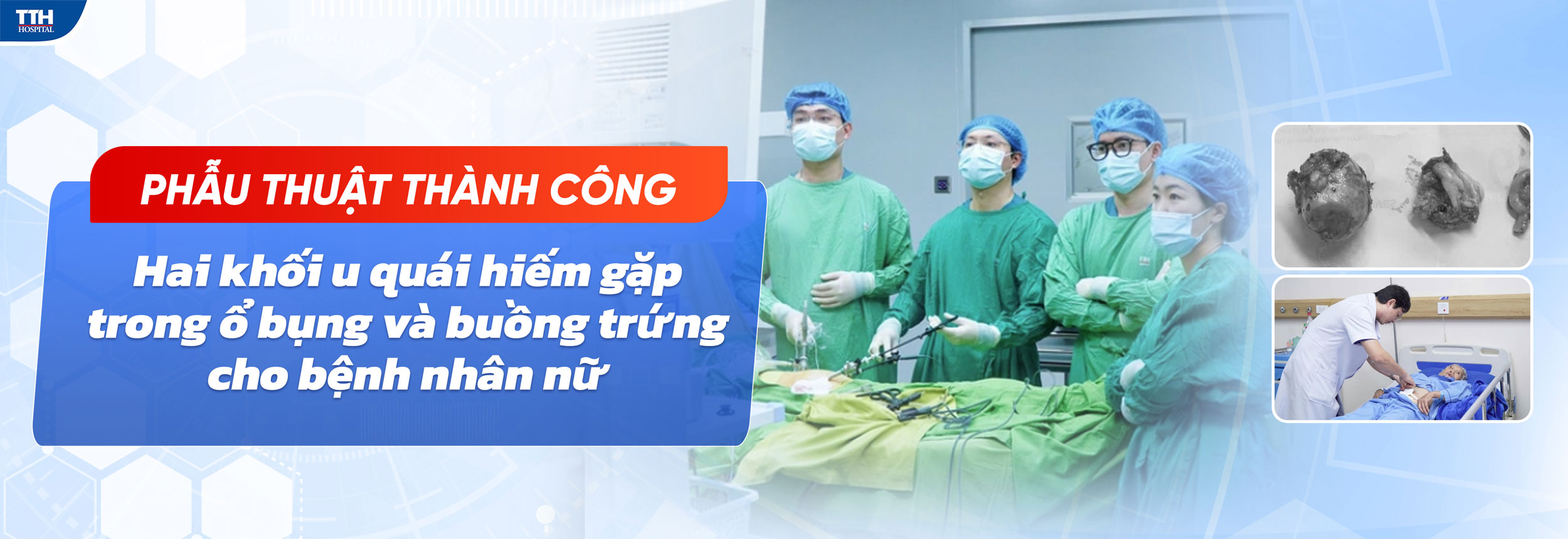 PHẪU THUẬT THÀNH CÔNG HAI KHỐI U QUÁI HIẾM GẶP TRONG Ổ BỤNG VÀ BUỒNG TRỨNG CHO BỆNH NHÂN NỮ