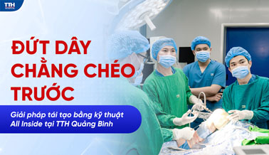 ĐỨT DÂY CHẰNG CHÉO TRƯỚC: GIẢI PHÁP TÁI TẠO BẰNG KỸ THUẬT ALL INSIDE TẠI TTH QUẢNG BÌNH