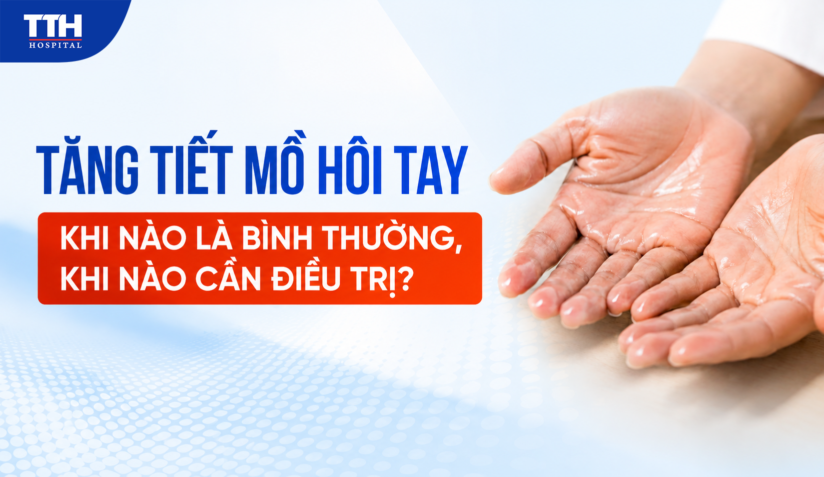 TĂNG TIẾT MỒ HÔI TAY: KHI NÀO LÀ BÌNH THƯỜNG, KHI NÀO CẦN ĐIỀU TRỊ?
