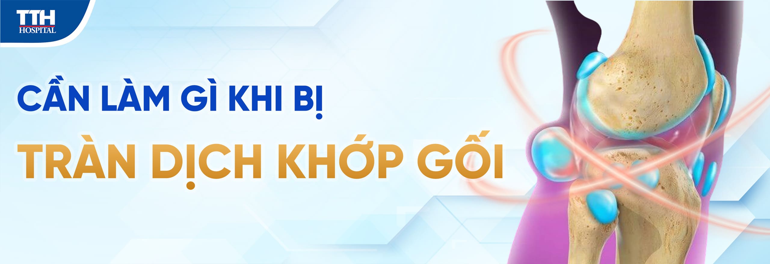 Tràn dịch khớp gối có nguy hiểm không?