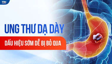 UNG THƯ DẠ DÀY: DẤU HIỆU SỚM DỄ BỊ BỎ QUA