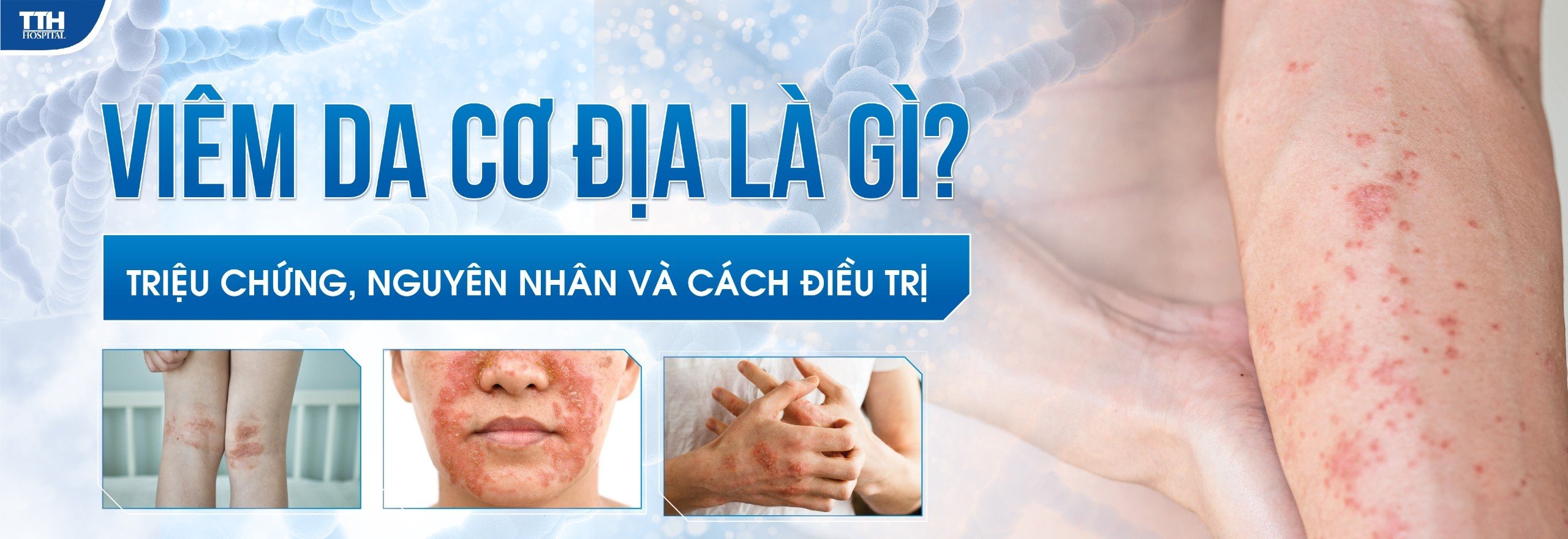 VIÊM DA CƠ ĐỊA LÀ GÌ? NGUYÊN NHÂN TRIỆU CHỨNG VÀ CÁCH ĐIỀU TRỊ?